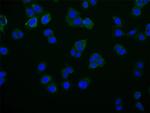 RAB25 Recombinant Rabbit Monoclonal Antibody (27H3)
