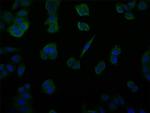 USP14 Recombinant Rabbit Monoclonal Antibody (28C4)