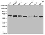 USP14 Antibody in Western Blot (WB)