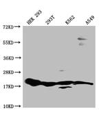 RPS19 Recombinant Rabbit Monoclonal Antibody (7E6)
