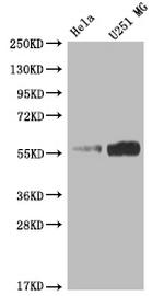 NUF2 Recombinant Rabbit Monoclonal Antibody (8B7)