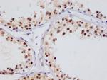 HIF1AN Antibody in Immunohistochemistry (Paraffin) (IHC (P))
