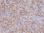 OS9 Recombinant Rabbit Monoclonal Antibody (26H3)