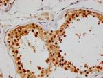COPS3 Antibody in Immunohistochemistry (Paraffin) (IHC (P))
