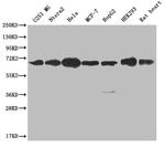 CBX2 Recombinant Rabbit Monoclonal Antibody (24A2)