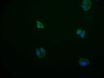 PDE2A Recombinant Rabbit Monoclonal Antibody (11C6)