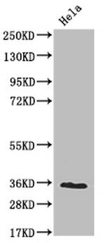 NUDT5 Recombinant Rabbit Monoclonal Antibody (10D2)