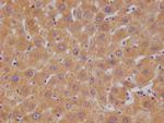HGD Antibody in Immunohistochemistry (Paraffin) (IHC (P))