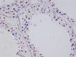 CRTC3 Recombinant Rabbit Monoclonal Antibody (10G3)