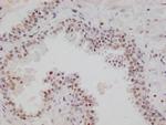 RGS6 Antibody in Immunohistochemistry (Paraffin) (IHC (P))