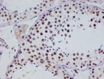 RGS6 Antibody in Immunohistochemistry (Paraffin) (IHC (P))