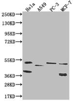TAPP1 Recombinant Rabbit Monoclonal Antibody (16C9)