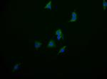 PAH Recombinant Rabbit Monoclonal Antibody (17D10)