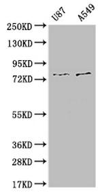 SLC25A12 Recombinant Rabbit Monoclonal Antibody (10B12)