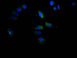 CD147 Recombinant Mouse Monoclonal Antibody (11F3)