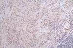 Formyl-Histone H3 (Lys122) Antibody in Immunohistochemistry (Paraffin) (IHC (P))