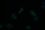 ATP7B Recombinant Rabbit Monoclonal Antibody (36D12)