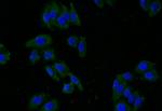 GLUT2 Recombinant Rabbit Monoclonal Antibody (37E1)