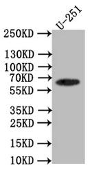GLT-1 Recombinant Rabbit Monoclonal Antibody (28F9)