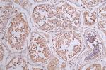 Phospho-ErbB2 (HER-2) (Tyr1139) Antibody in Immunohistochemistry (Paraffin) (IHC (P))