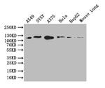 DDR2 Recombinant Rabbit Monoclonal Antibody (9A9)