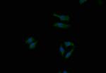 Themis Recombinant Rabbit Monoclonal Antibody (7G7)