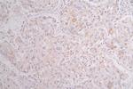 Cytokeratin 10 Antibody in Immunohistochemistry (Paraffin) (IHC (P))