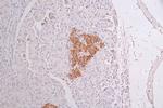 Cytokeratin 10 Recombinant Rabbit Monoclonal Antibody (18B6)