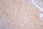 CRP Recombinant Rabbit Monoclonal Antibody (10F7)