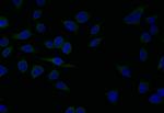 SERCA2 ATPase Recombinant Rabbit Monoclonal Antibody (20D1)