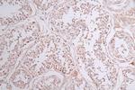SOCS7 Antibody in Immunohistochemistry (Paraffin) (IHC (P))