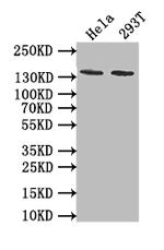 PKN2 Recombinant Rabbit Monoclonal Antibody (11H3)