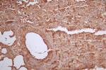 BAX Antibody in Immunohistochemistry (Paraffin) (IHC (P))
