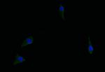 ASS1 Recombinant Rabbit Monoclonal Antibody (18G11)