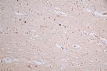 Phospho-MDM2 (Ser166) Antibody in Immunohistochemistry (Paraffin) (IHC (P))