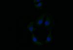 Cytokeratin 6A Recombinant Rabbit Monoclonal Antibody (21E2)