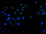 PITX3 Recombinant Rabbit Monoclonal Antibody (28A9)