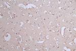 Paxillin Antibody in Immunohistochemistry (Paraffin) (IHC (P))