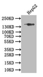 COL17A1 Recombinant Rabbit Monoclonal Antibody (15G9)