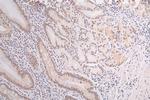 DEK Antibody in Immunohistochemistry (Paraffin) (IHC (P))