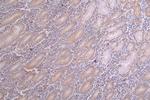 Acetyl-SOD2 (Lys68) Recombinant Rabbit Monoclonal Antibody (23G5)