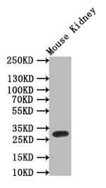 TPSB2 Recombinant Rabbit Monoclonal Antibody (9H6)