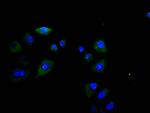 CD16 Recombinant Rabbit Monoclonal Antibody (25G6)