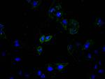 ATP7B Recombinant Rabbit Monoclonal Antibody (24A4)