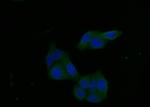 FGFR1 Recombinant Rabbit Monoclonal Antibody (10A9)