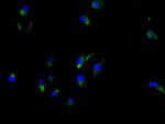CEA Recombinant Rabbit Monoclonal Antibody (4D8)
