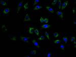 CEA Antibody in Immunocytochemistry (ICC/IF)