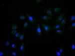 SNRPD1 Recombinant Mouse Monoclonal Antibody (24E2)