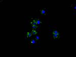 Gelsolin Antibody in Immunocytochemistry (ICC/IF)