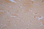 Fascin Antibody in Immunohistochemistry (Paraffin) (IHC (P))